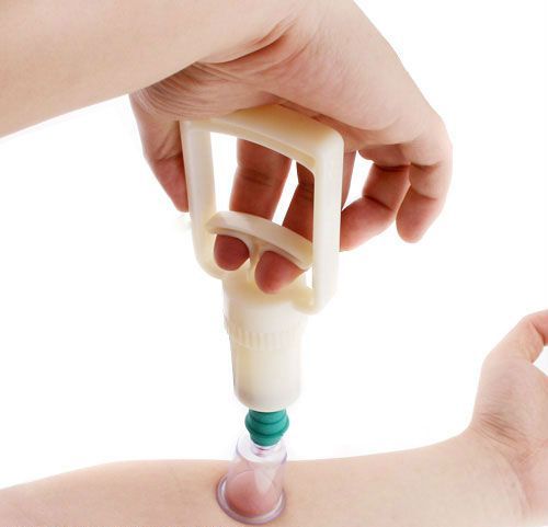 Vakuové masážní baňky 6 kusů se sací pumpou DYKL 1270031
